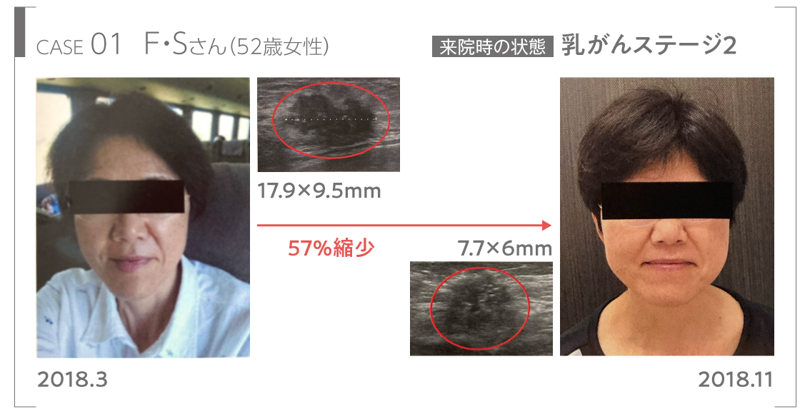 case1:がん患者の状態が良くなったビフォーアフター画像